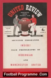 Manchester United v Hibernian Hibs 1952 – Special Friendly Match