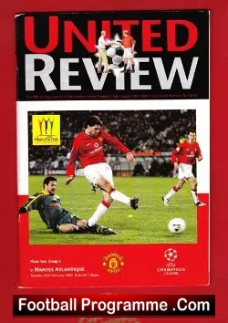 Manchester United v Nantes Atlantique 2002 – France Team