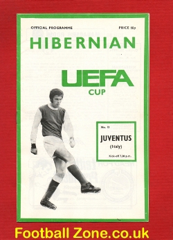 Hibernian Hibs v Juventus 1974 – Juve Italy