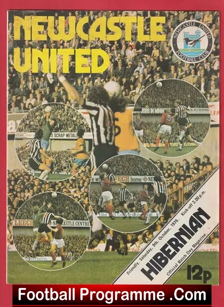 Newcastle United v Hibernian Hibs 1976 – Friendly Match