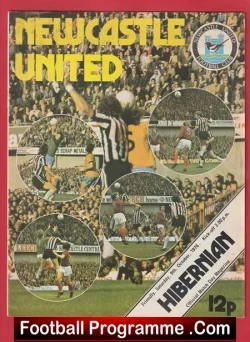 Newcastle United v Hibernian Hibs 1976 – Friendly Match